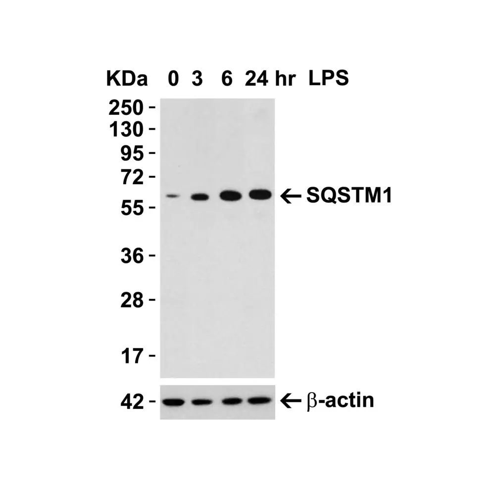ProSci 5449_S SQSTM1 Antibody, ProSci, 0.02 mg/Unit Tertiary Image