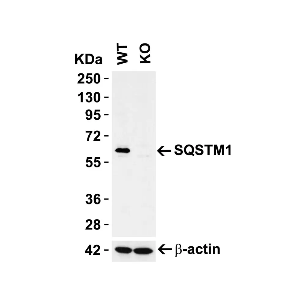 ProSci 5449 SQSTM1 Antibody, ProSci, 0.1 mg/Unit Primary Image