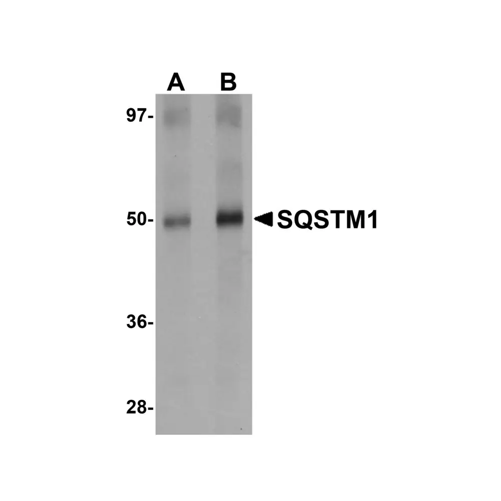 ProSci 5449_S SQSTM1 Antibody, ProSci, 0.02 mg/Unit Quaternary Image