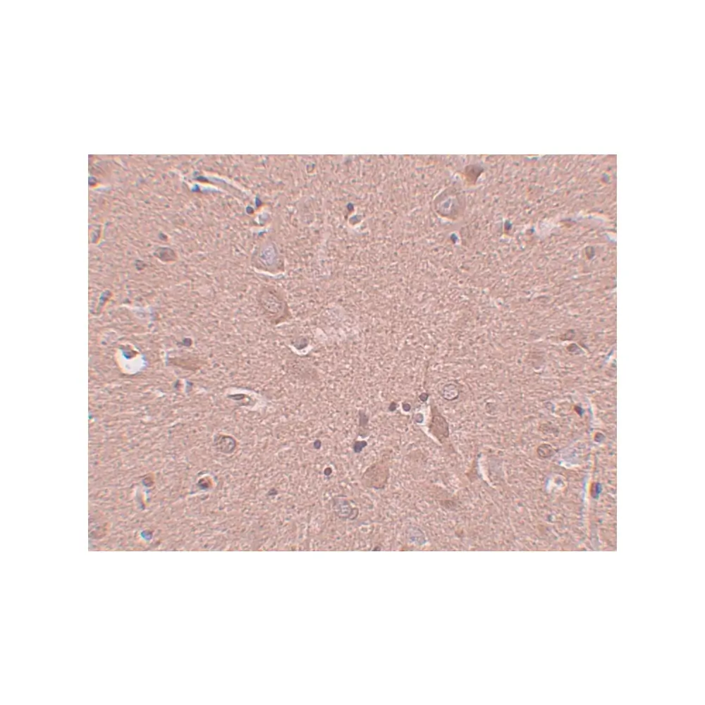 ProSci 5473 SRPX1 Antibody, ProSci, 0.1 mg/Unit Secondary Image