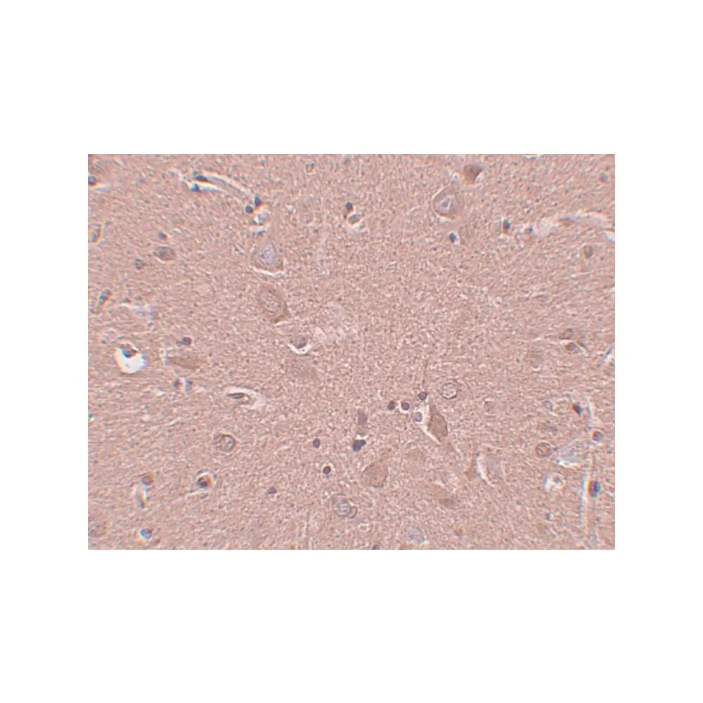 ProSci 5473_S SRPX1 Antibody, ProSci, 0.02 mg/Unit Secondary Image