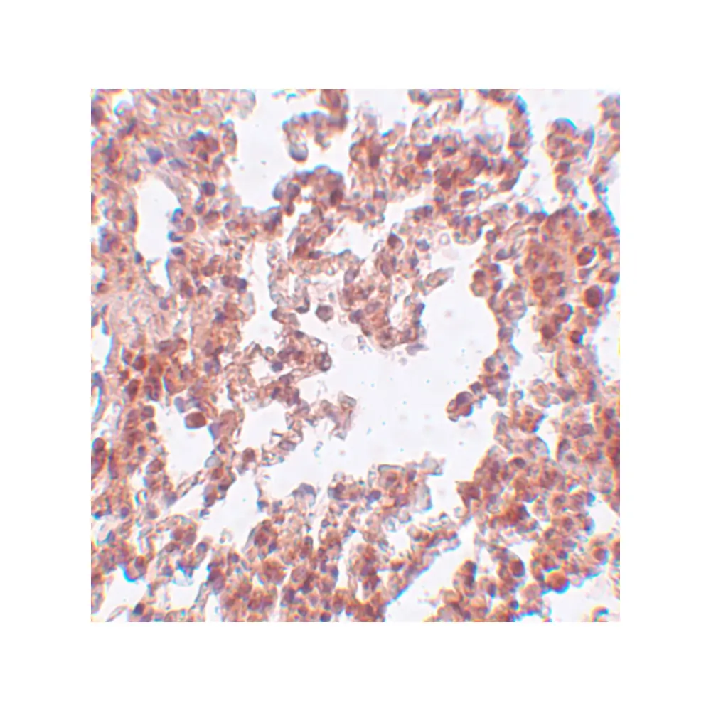 ProSci 5475_S SRPX2 Antibody, ProSci, 0.02 mg/Unit Secondary Image