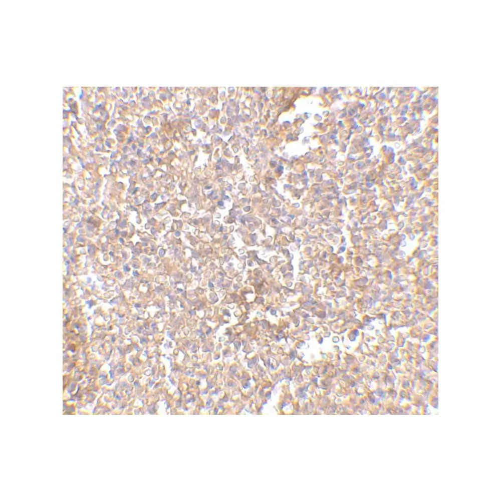 ProSci 4305_S STEAP1 Antibody, ProSci, 0.02 mg/Unit Secondary Image