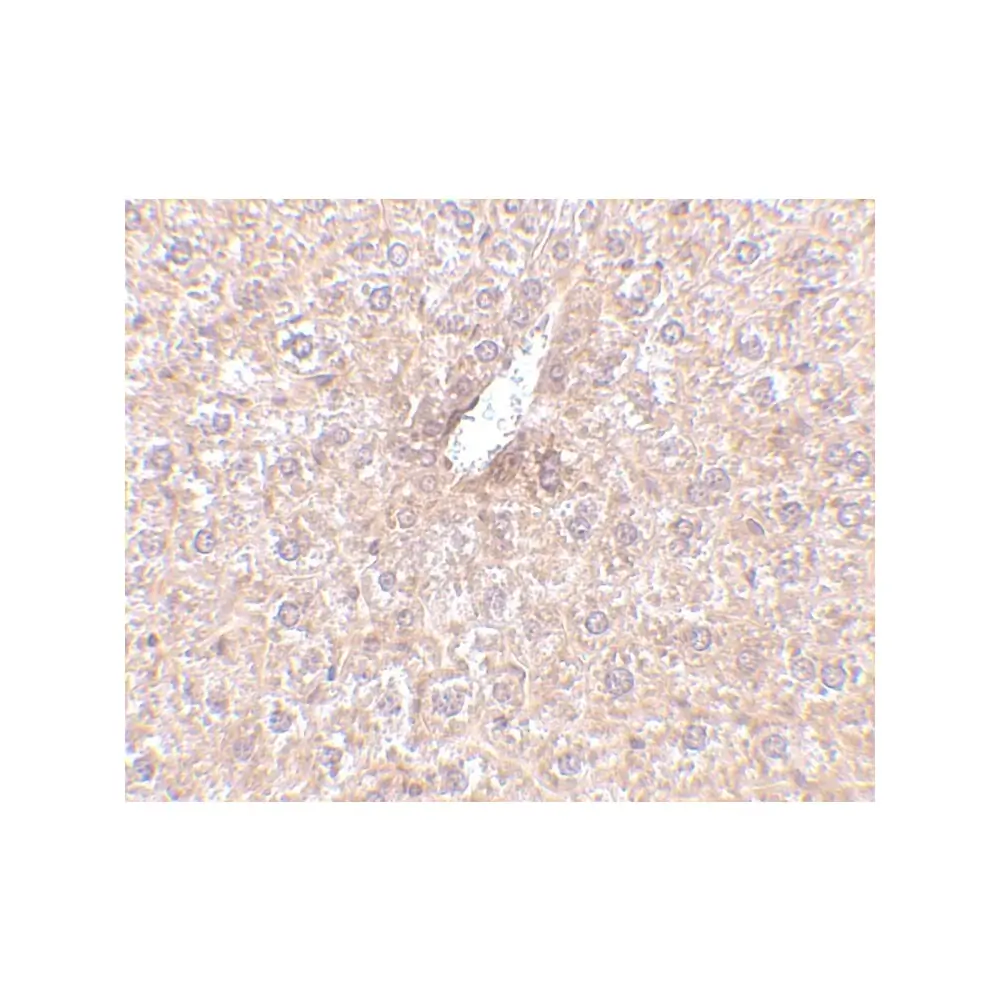 ProSci 4311_S STEAP3 Antibody, ProSci, 0.02 mg/Unit Secondary Image