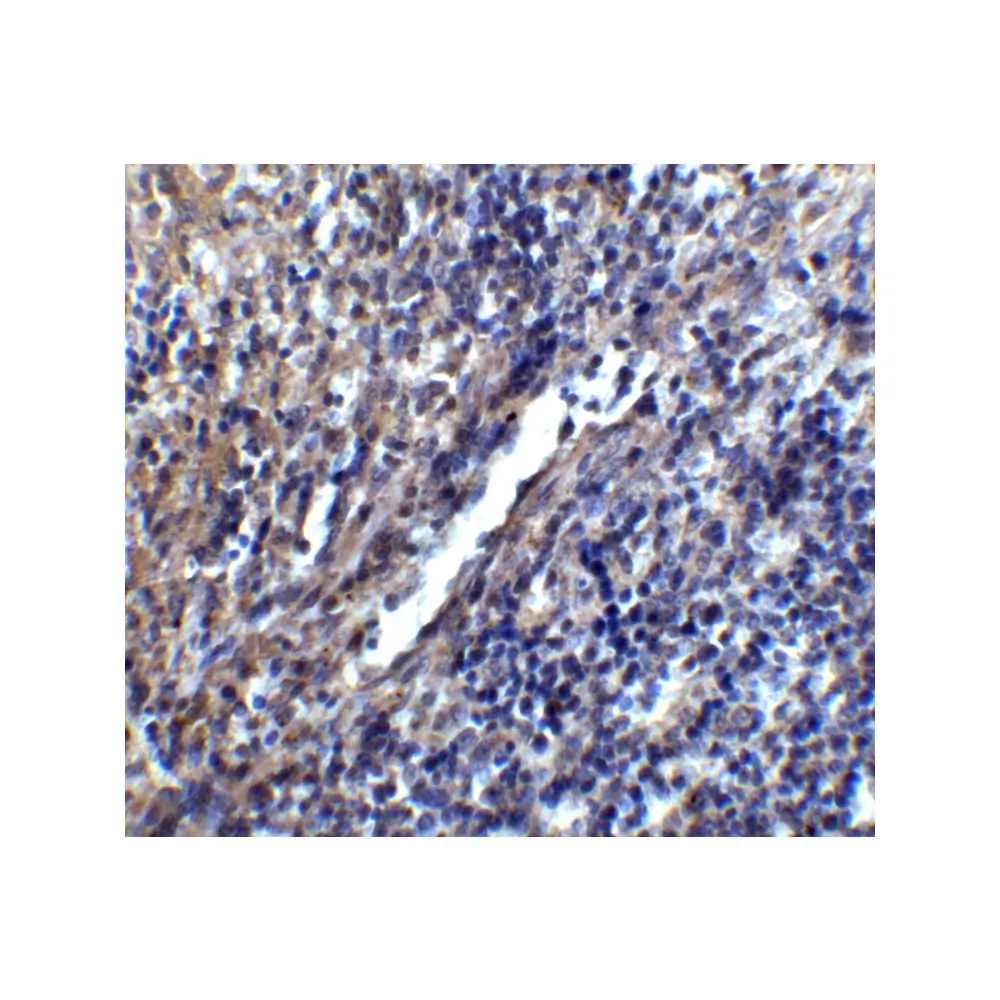 ProSci 4119 STIM1 Antibody, ProSci, 0.1 mg/Unit Tertiary Image