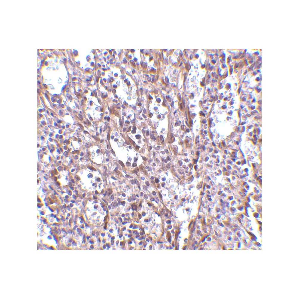ProSci 4119 STIM1 Antibody, ProSci, 0.1 mg/Unit Secondary Image