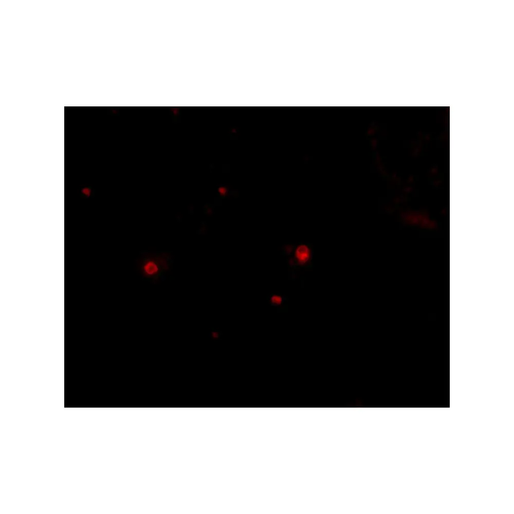 ProSci 4123 STIM2 Antibody, ProSci, 0.1 mg/Unit Tertiary Image