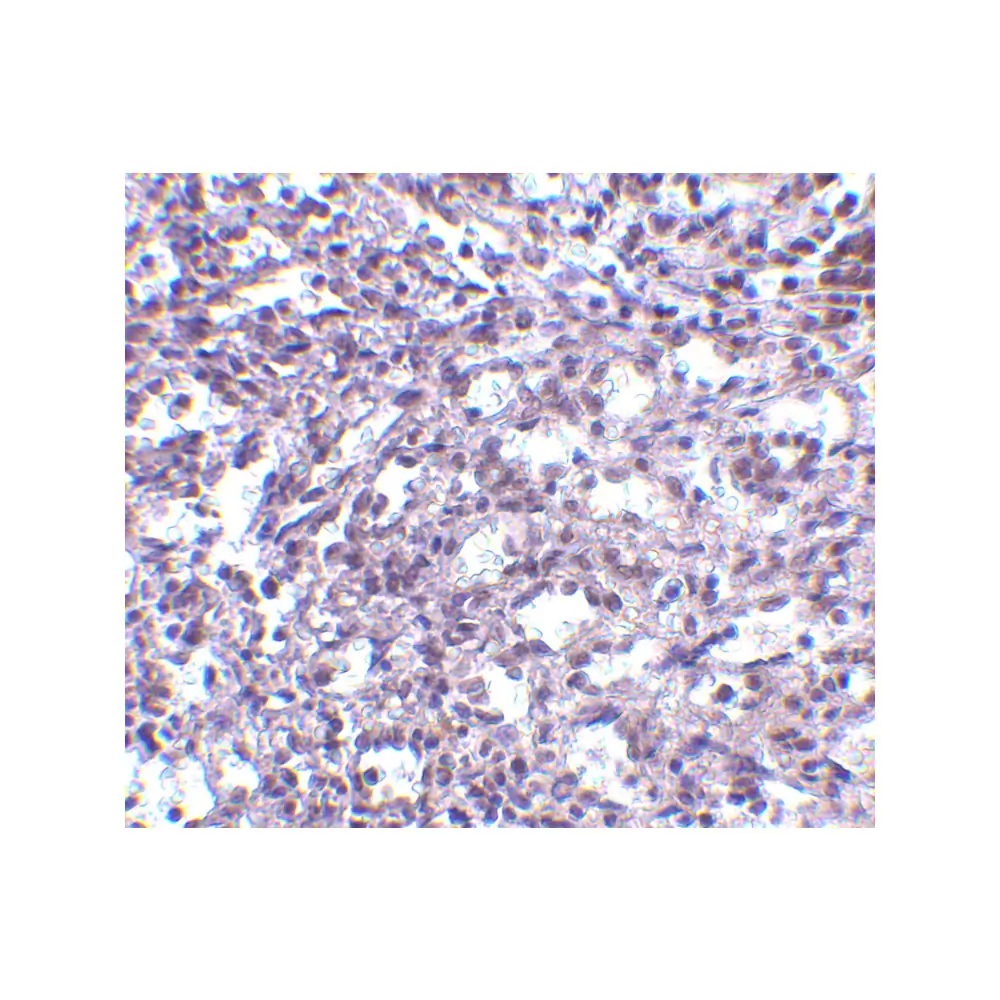 ProSci 4123_S STIM2 Antibody, ProSci, 0.02 mg/Unit Secondary Image