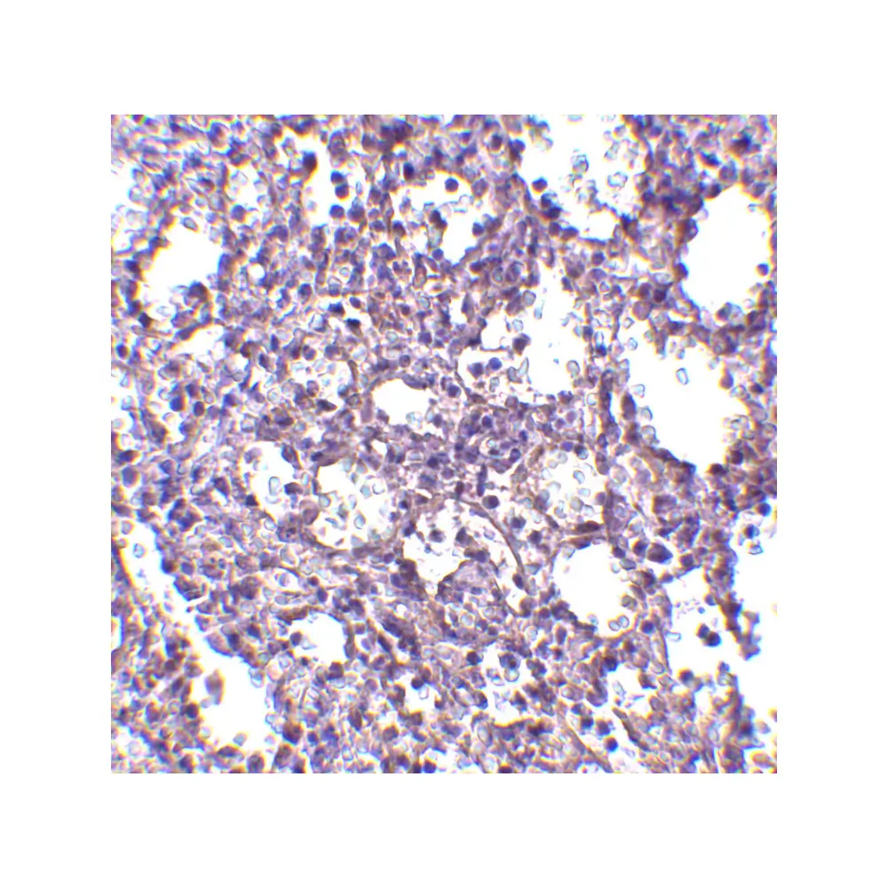 ProSci 4125 STIM2 Antibody, ProSci, 0.1 mg/Unit Secondary Image