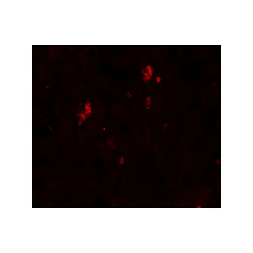 ProSci 5755 SUMO2/3 Antibody, ProSci, 0.1 mg/Unit Tertiary Image