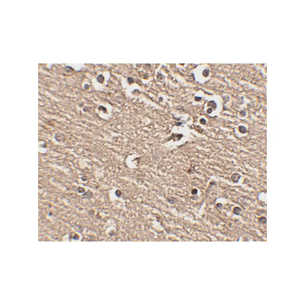 ProSci 4453 Slitrk1 Antibody, ProSci, 0.1 mg/Unit Secondary Image