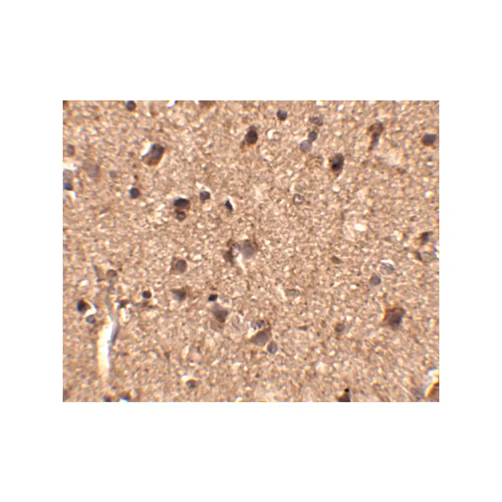 ProSci 4455_S Slitrk1 Antibody, ProSci, 0.02 mg/Unit Secondary Image