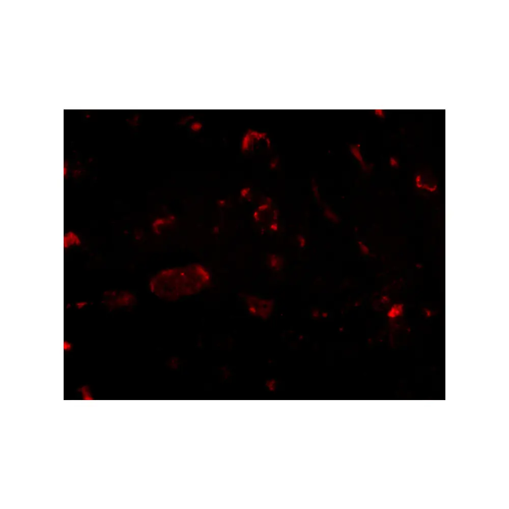 ProSci 4459_S Slitrk2 Antibody, ProSci, 0.02 mg/Unit Tertiary Image