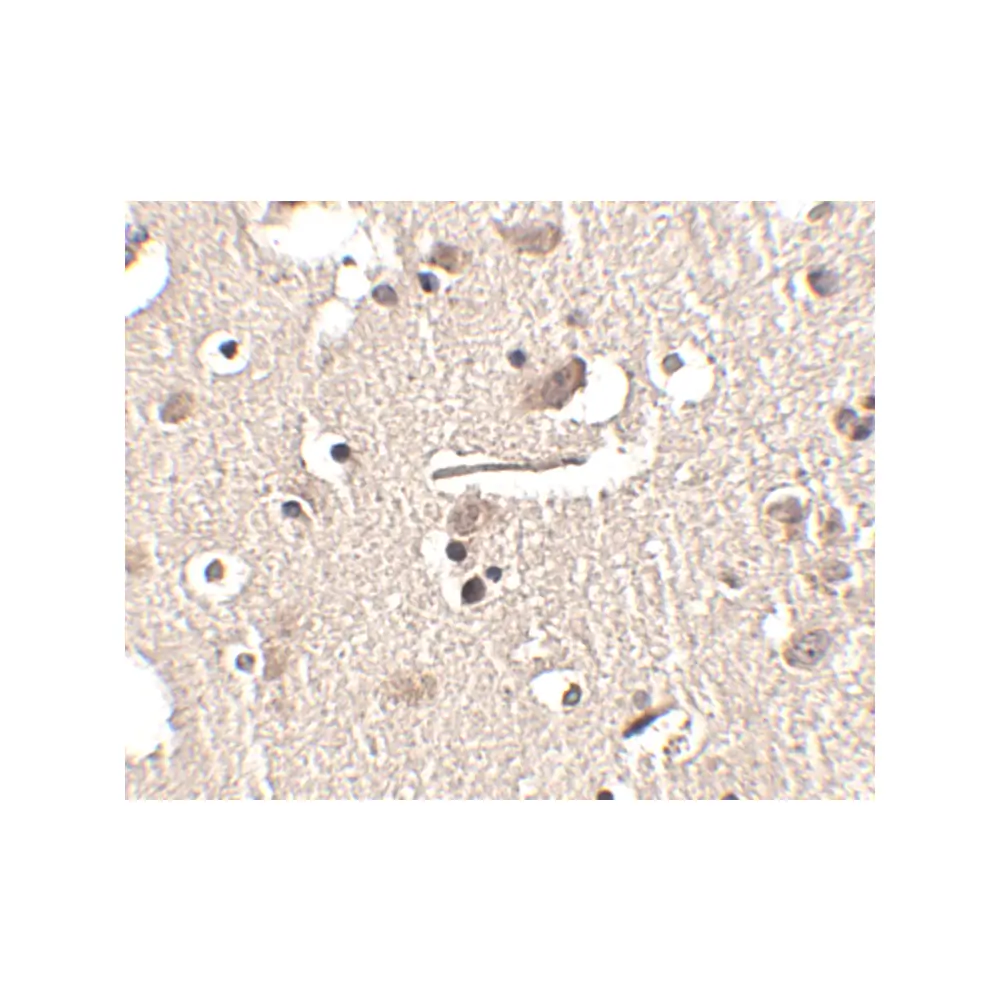 ProSci 4459 Slitrk2 Antibody, ProSci, 0.1 mg/Unit Secondary Image