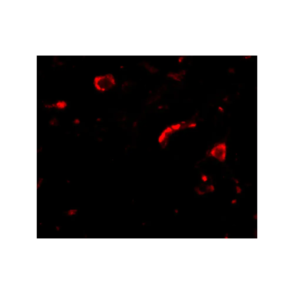 ProSci 4463_S Slitrk3 Antibody, ProSci, 0.02 mg/Unit Tertiary Image