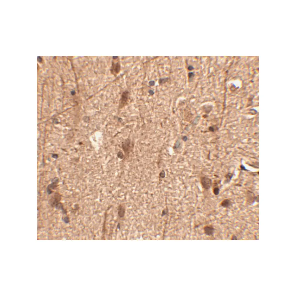 ProSci 4461 Slitrk3 Antibody, ProSci, 0.1 mg/Unit Secondary Image
