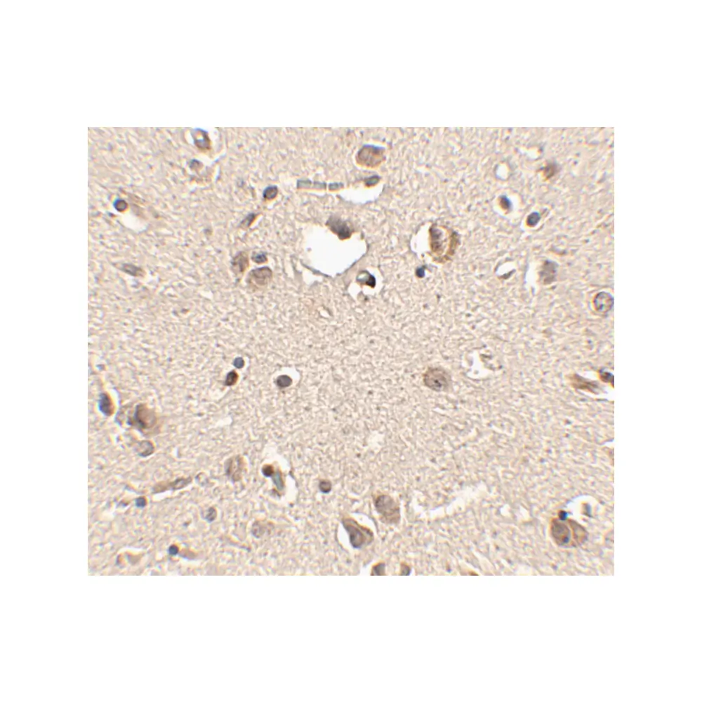 ProSci 4463_S Slitrk3 Antibody, ProSci, 0.02 mg/Unit Secondary Image