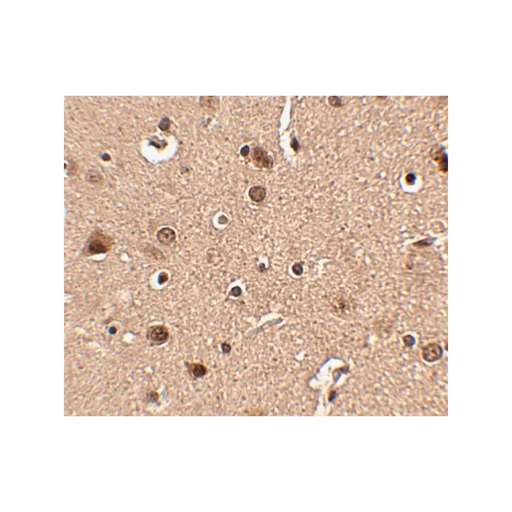 ProSci 4473 Slitrk4 Antibody, ProSci, 0.1 mg/Unit Secondary Image