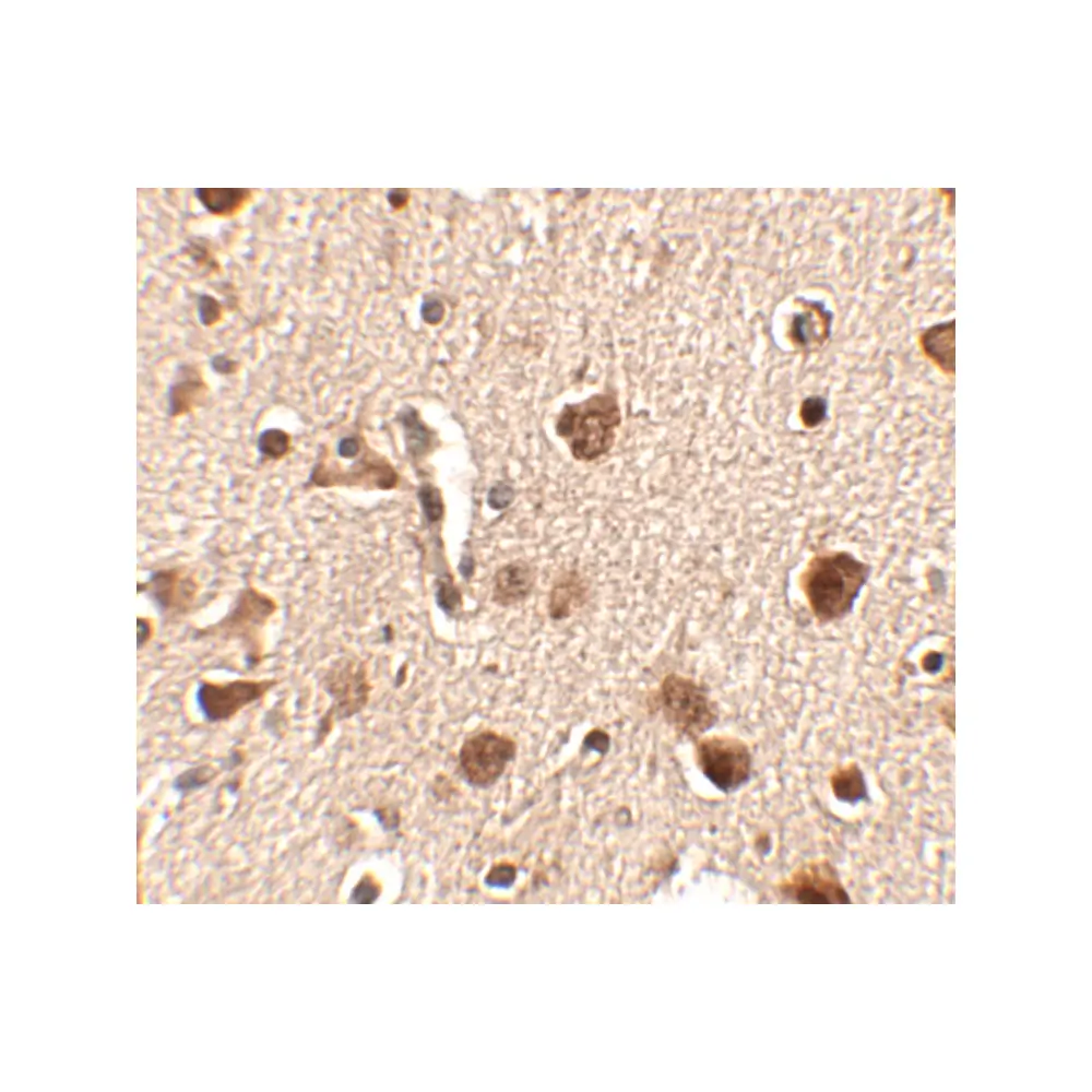 ProSci 4483_S Slitrk4 Antibody, ProSci, 0.02 mg/Unit Secondary Image