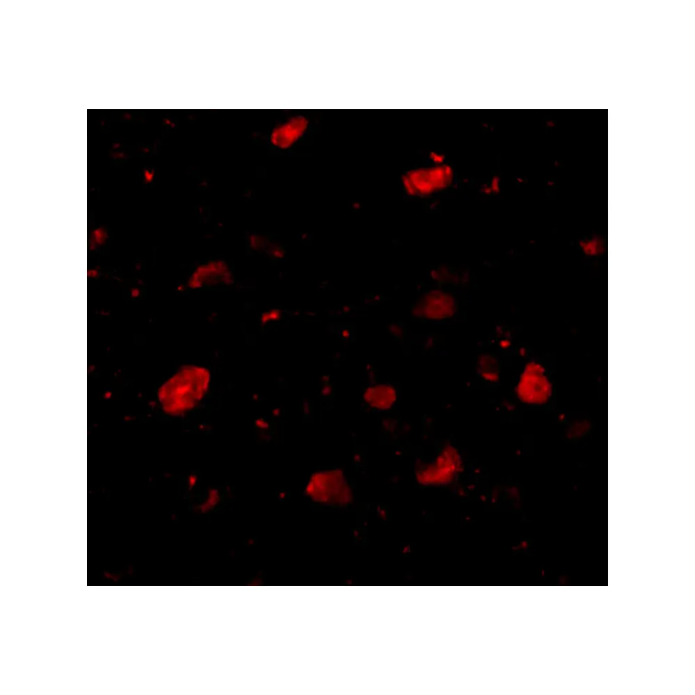 ProSci 4475 Slitrk5 Antibody, ProSci, 0.1 mg/Unit Tertiary Image
