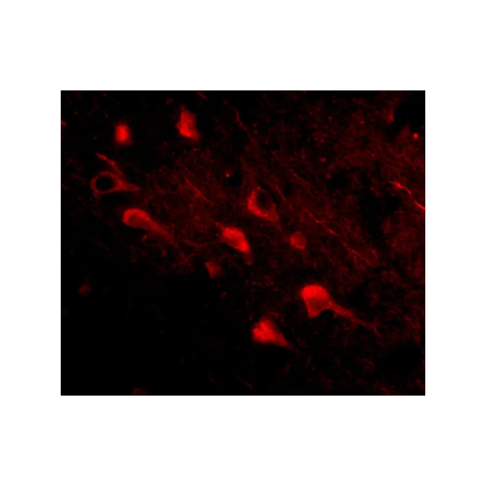 ProSci 4477 Slitrk5 Antibody, ProSci, 0.1 mg/Unit Tertiary Image