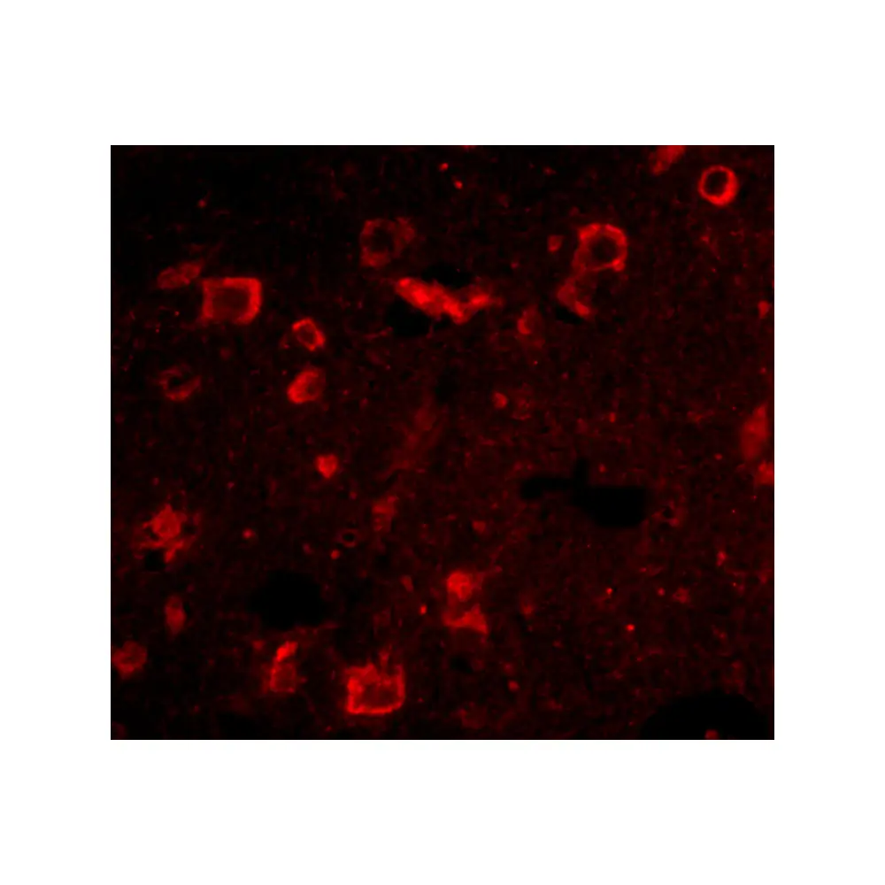 ProSci 4479_S Slitrk6 Antibody, ProSci, 0.02 mg/Unit Tertiary Image