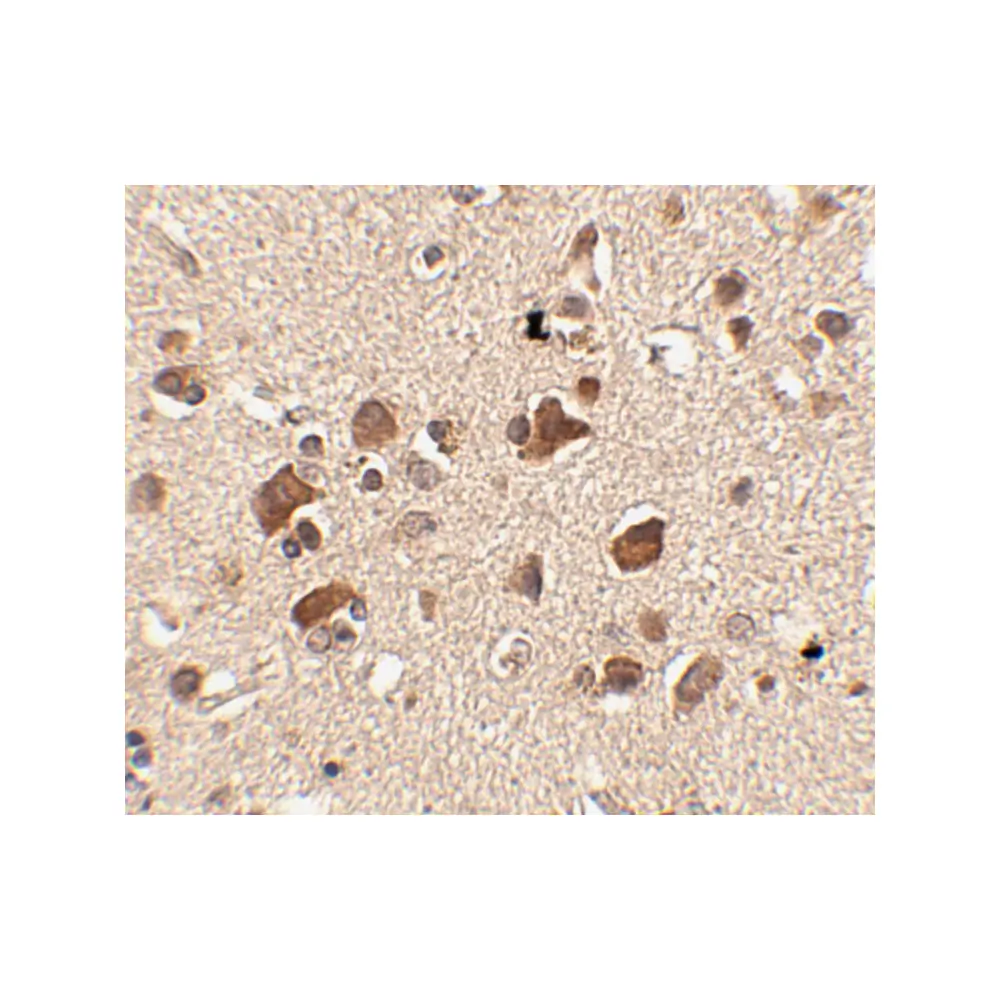 ProSci 4479_S Slitrk6 Antibody, ProSci, 0.02 mg/Unit Secondary Image