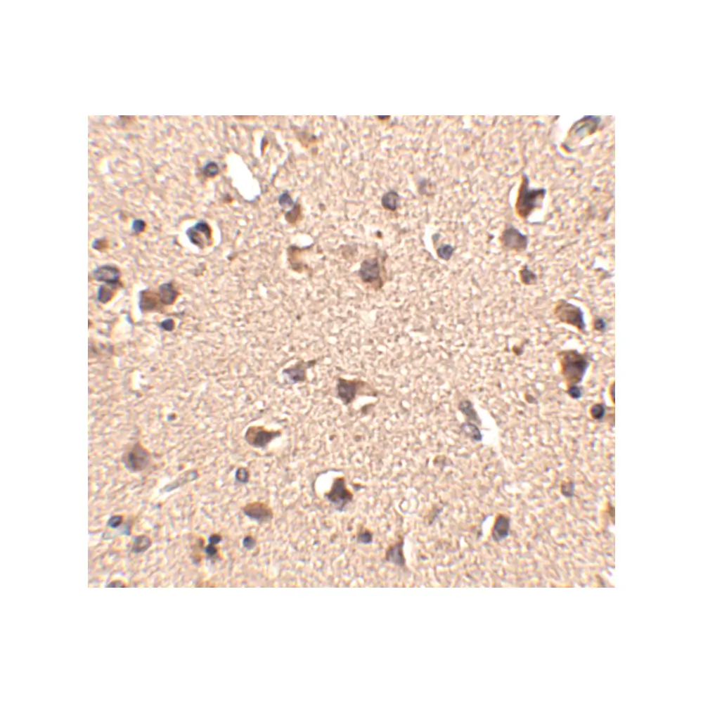 ProSci 4481 Slitrk6 Antibody, ProSci, 0.1 mg/Unit Secondary Image