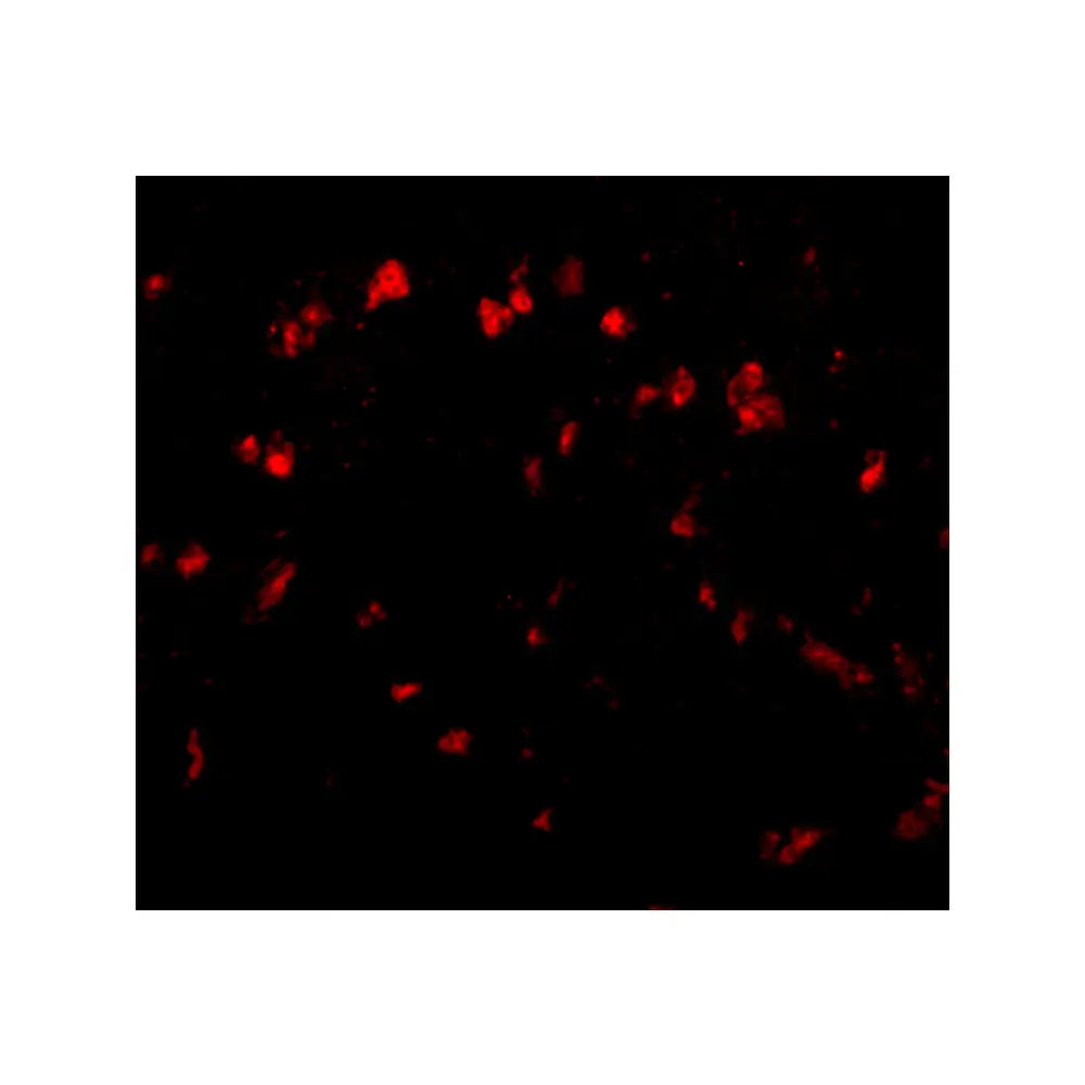 ProSci 4843 Spred1 Antibody, ProSci, 0.1 mg/Unit Tertiary Image