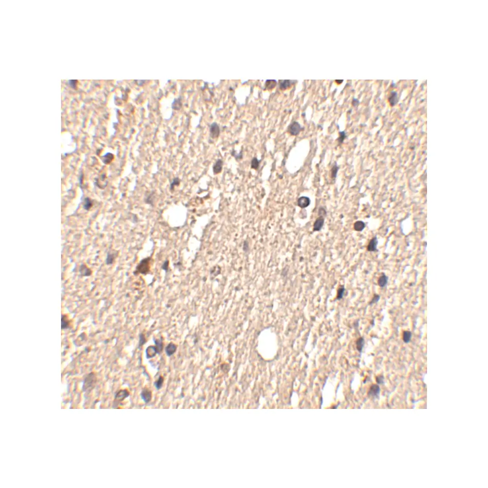 ProSci 4833 Spred1 Antibody, ProSci, 0.1 mg/Unit Secondary Image