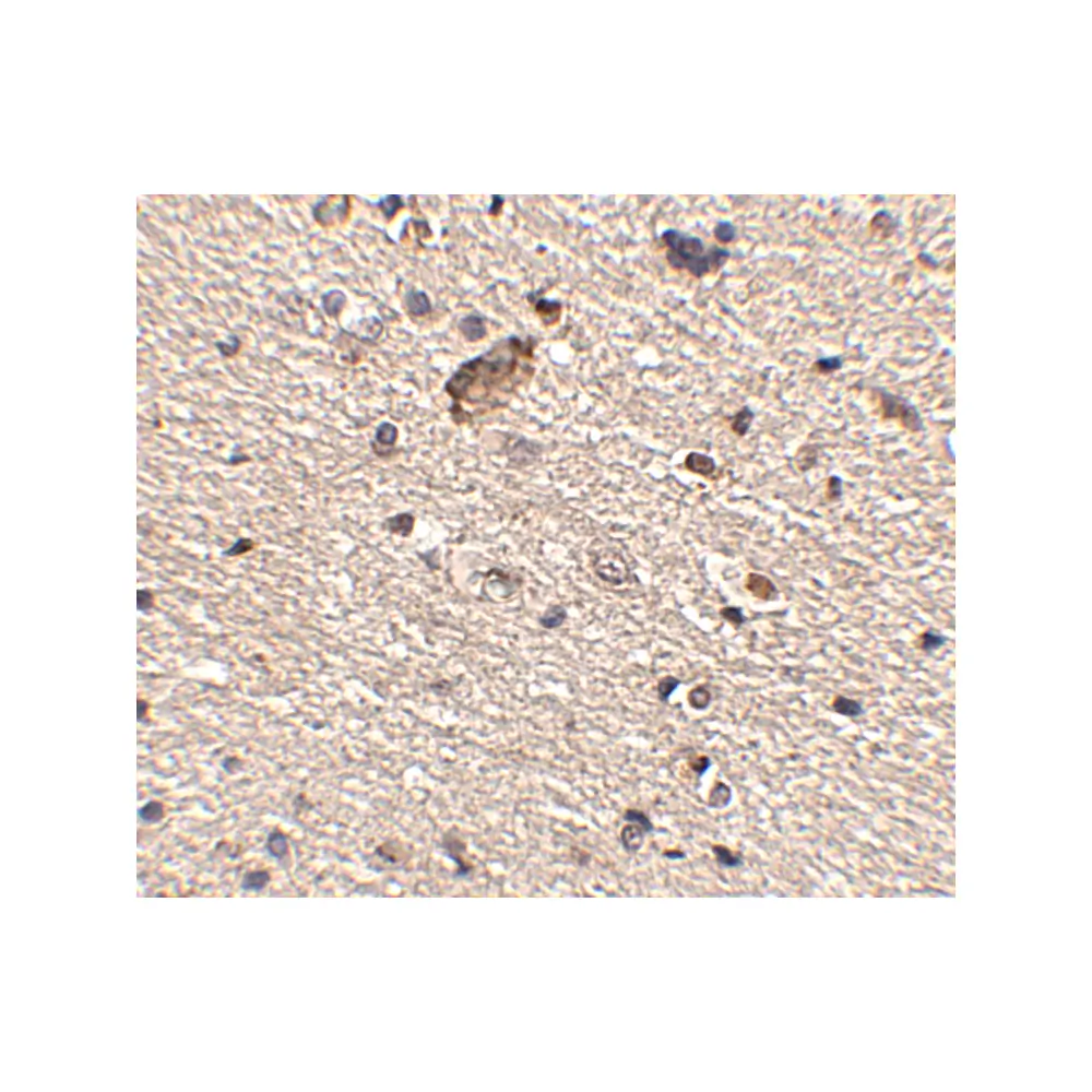 ProSci 4843 Spred1 Antibody, ProSci, 0.1 mg/Unit Secondary Image