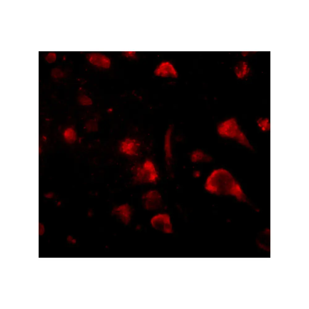 ProSci 4851_S Spred3 Antibody, ProSci, 0.02 mg/Unit Tertiary Image
