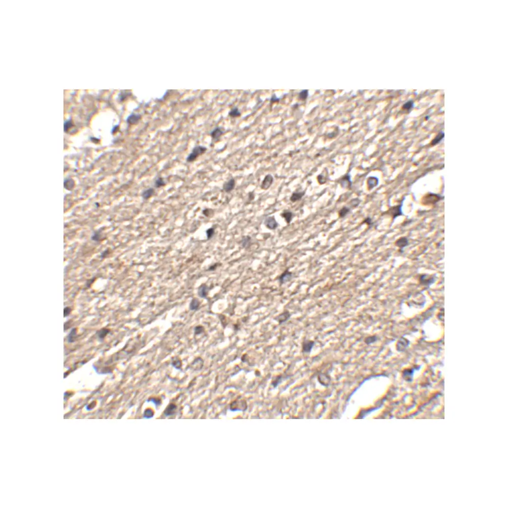 ProSci 4851_S Spred3 Antibody, ProSci, 0.02 mg/Unit Secondary Image