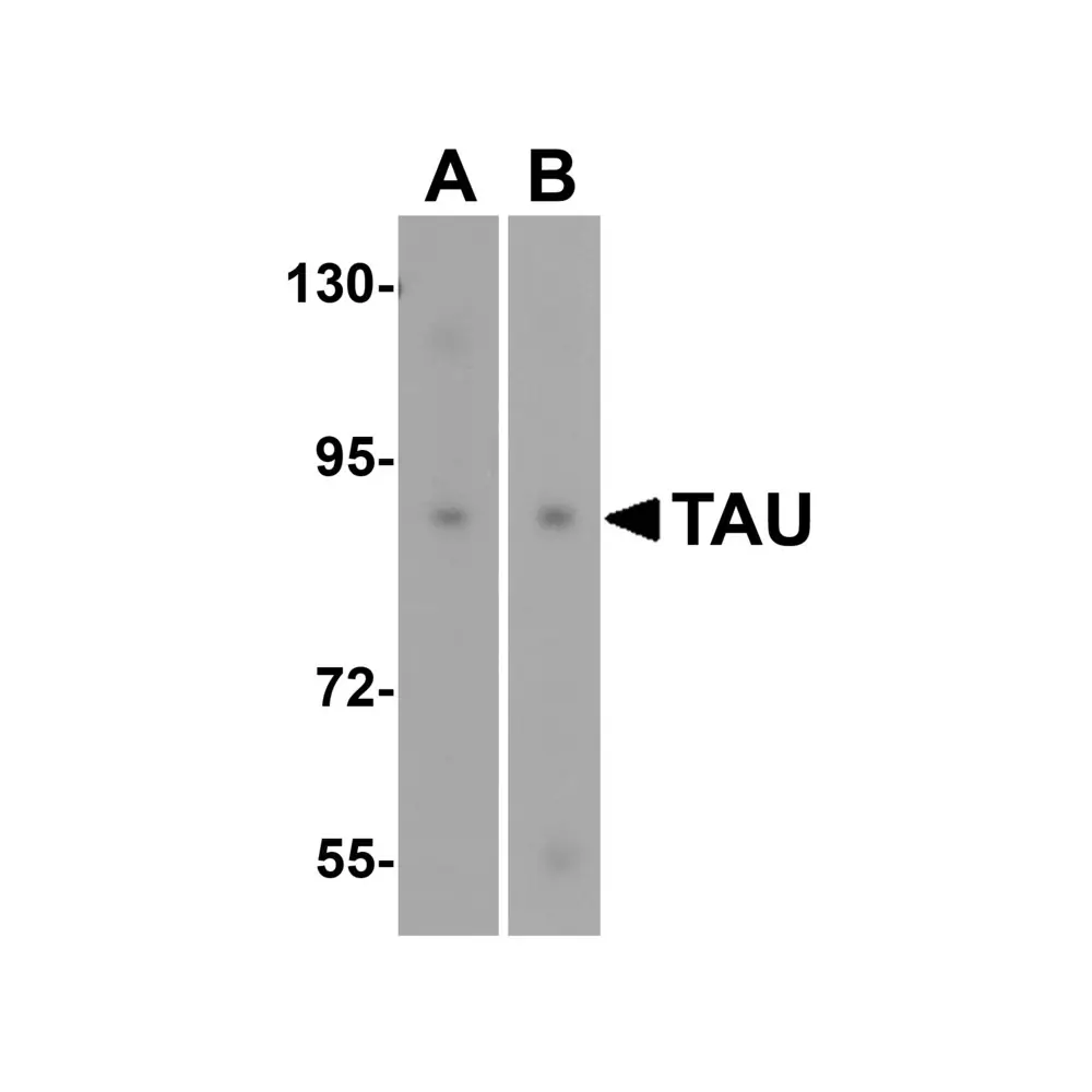 ProSci 8077 TAU Antibody, ProSci, 0.1 mg/Unit Quaternary Image