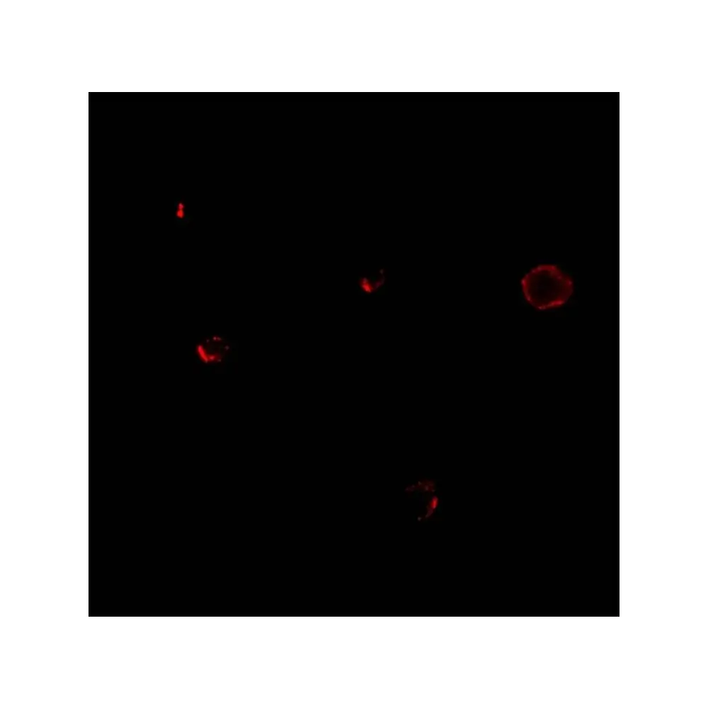 ProSci 2481_S TCCR Antibody, ProSci, 0.02 mg/Unit Tertiary Image