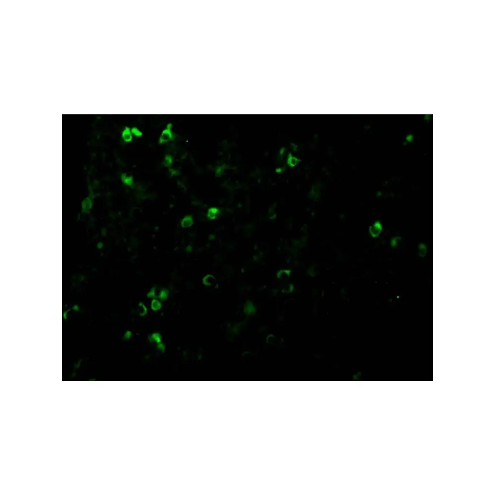 ProSci 2483_S TCCR Antibody, ProSci, 0.02 mg/Unit Tertiary Image