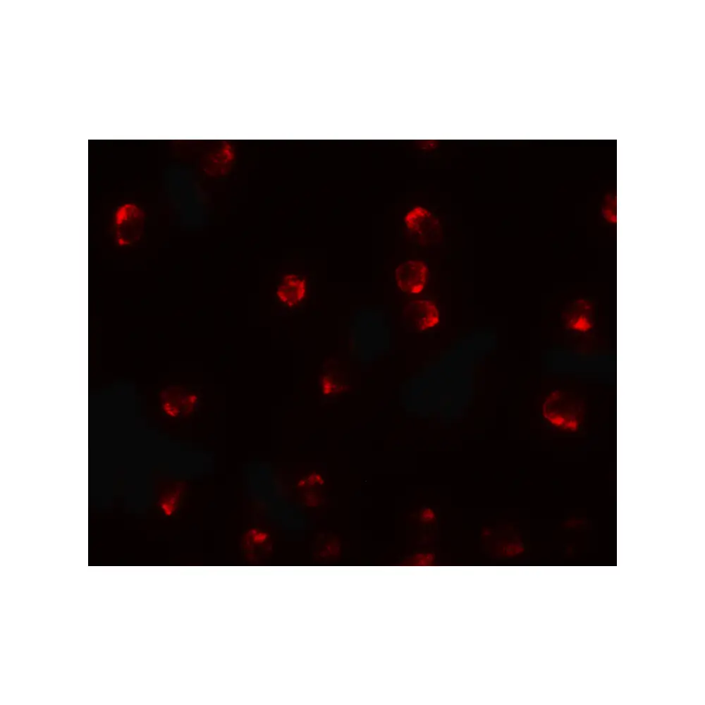 ProSci 6953_S TCTEX1D2 Antibody, ProSci, 0.02 mg/Unit Secondary Image