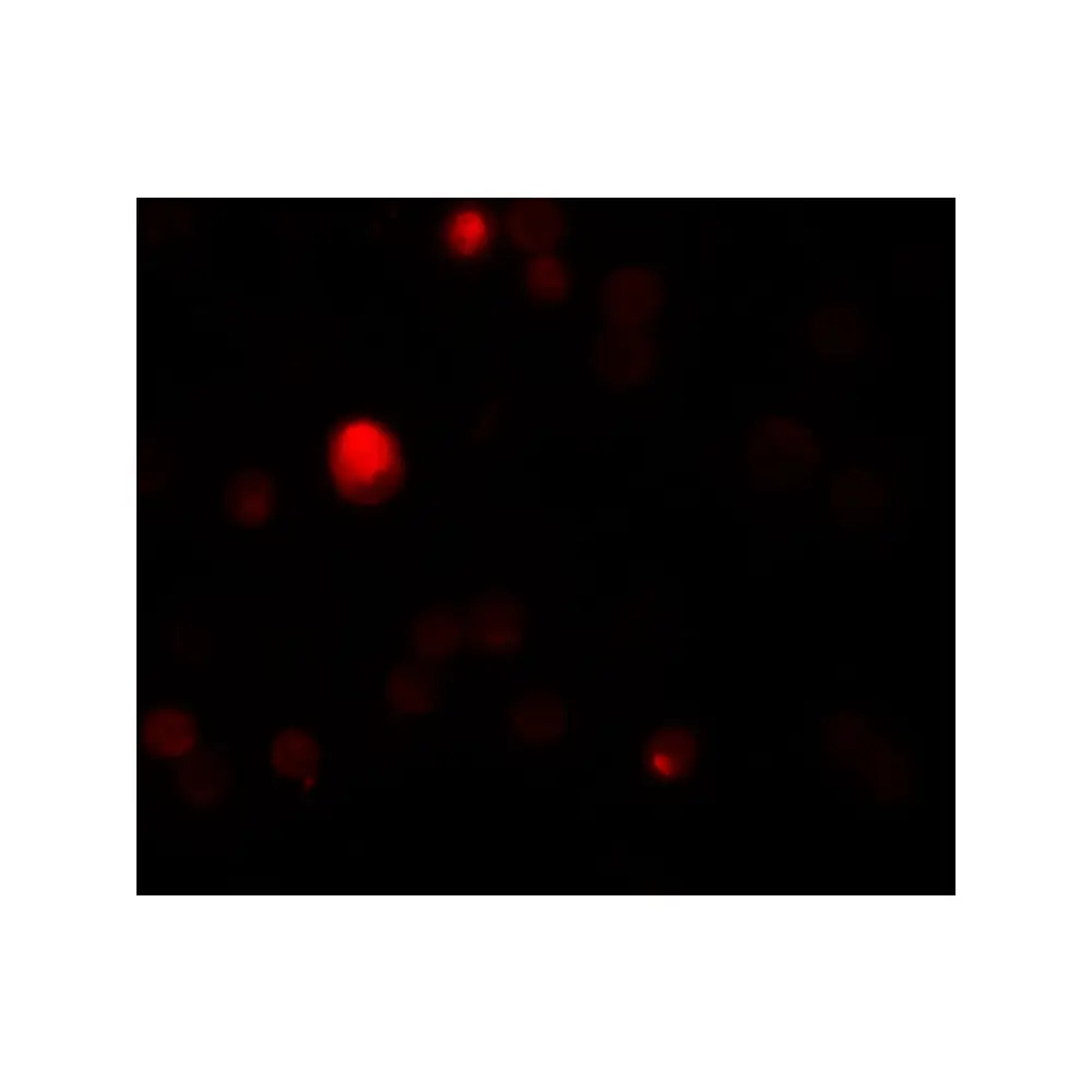 ProSci 5837_S TCTN3 Antibody, ProSci, 0.02 mg/Unit Tertiary Image