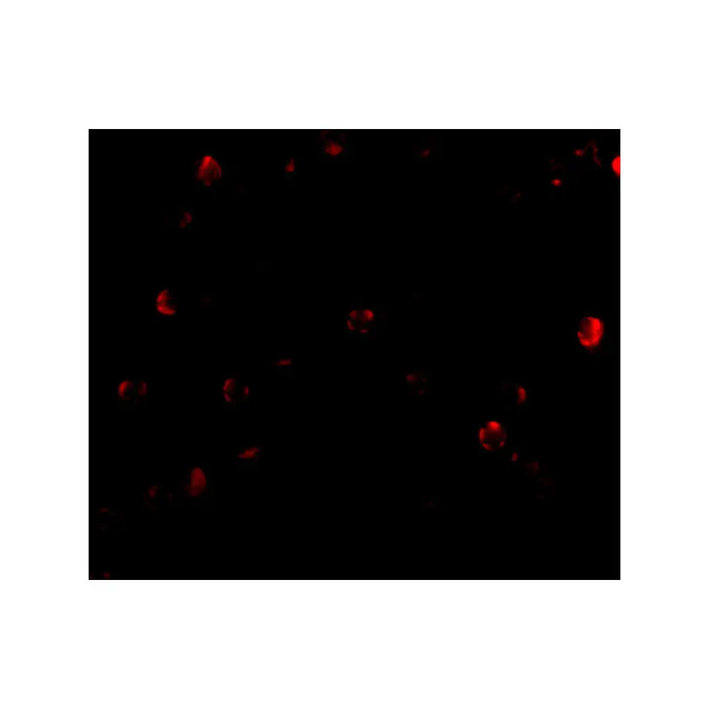 ProSci 4283_S TDP43 Antibody, ProSci, 0.02 mg/Unit Tertiary Image