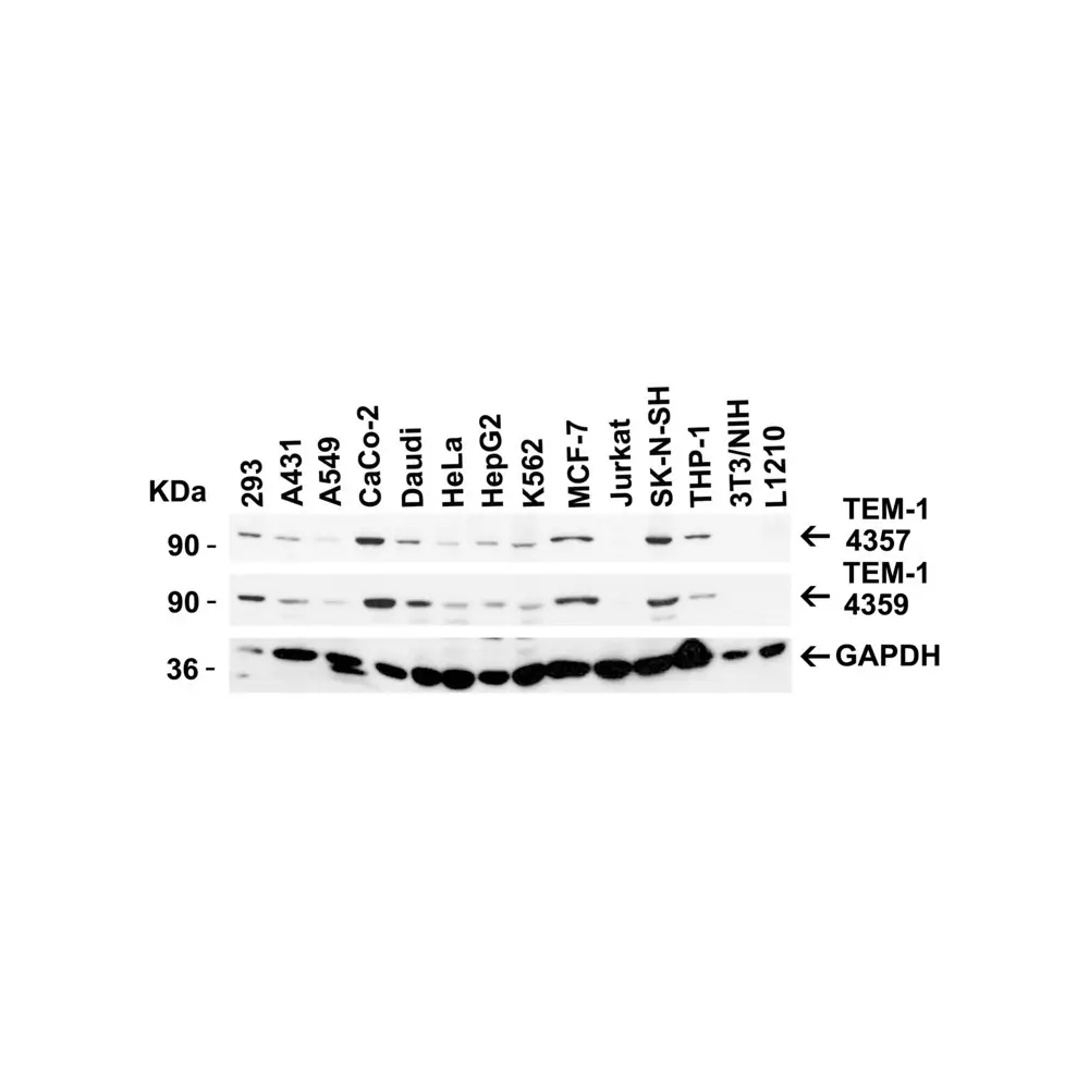 ProSci 4357_S TEM1 Antibody, ProSci, 0.02 mg/Unit Secondary Image