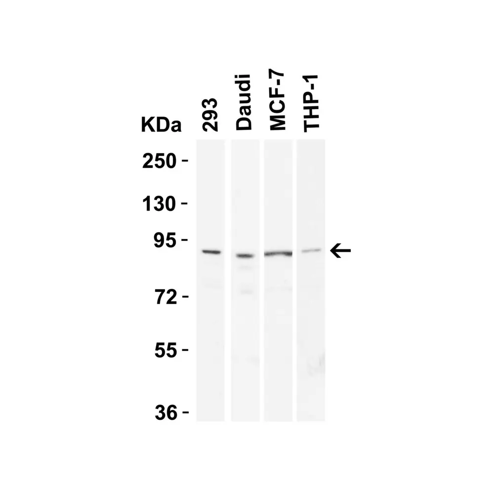 ProSci 4359 TEM1 Antibody, ProSci, 0.1 mg/Unit Tertiary Image