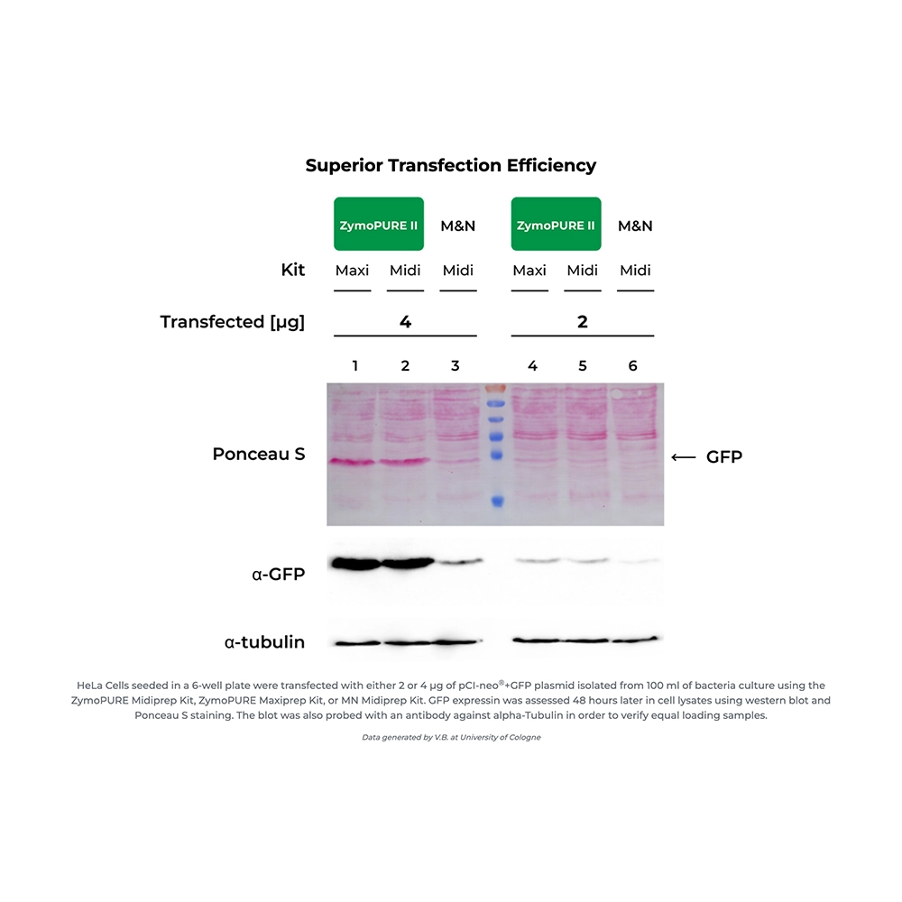 Zymo Research D4202 ZymoPURE II Plasmid Maxiprep Kit, up to 1200