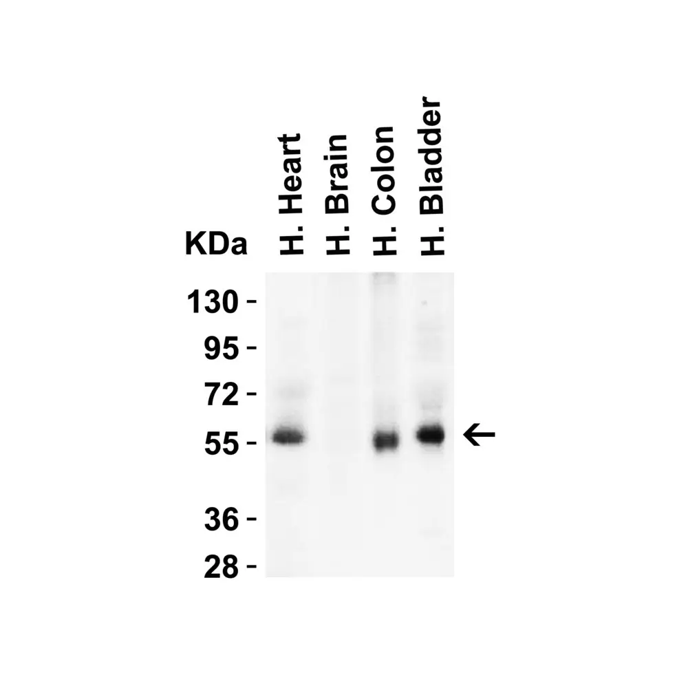ProSci 8963_S hRIP3 Antibody, ProSci, 0.02 mg/Unit Secondary Image