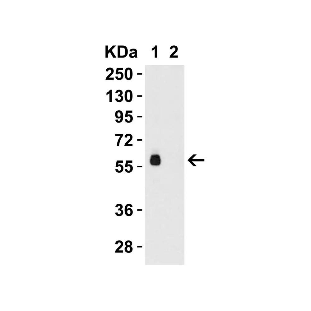 ProSci 8963_S hRIP3 Antibody, ProSci, 0.02 mg/Unit Tertiary Image