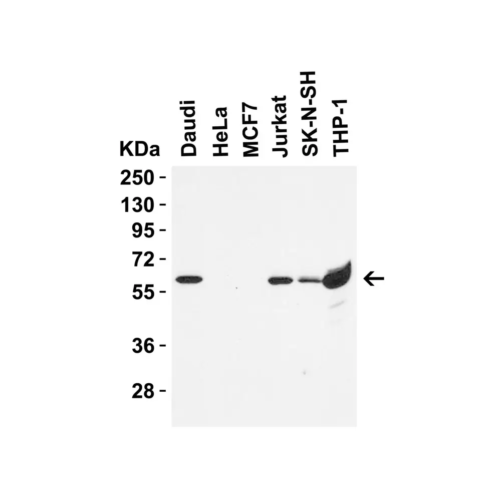 ProSci 8963 hRIP3 Antibody, ProSci, 0.1 mg/Unit Primary Image