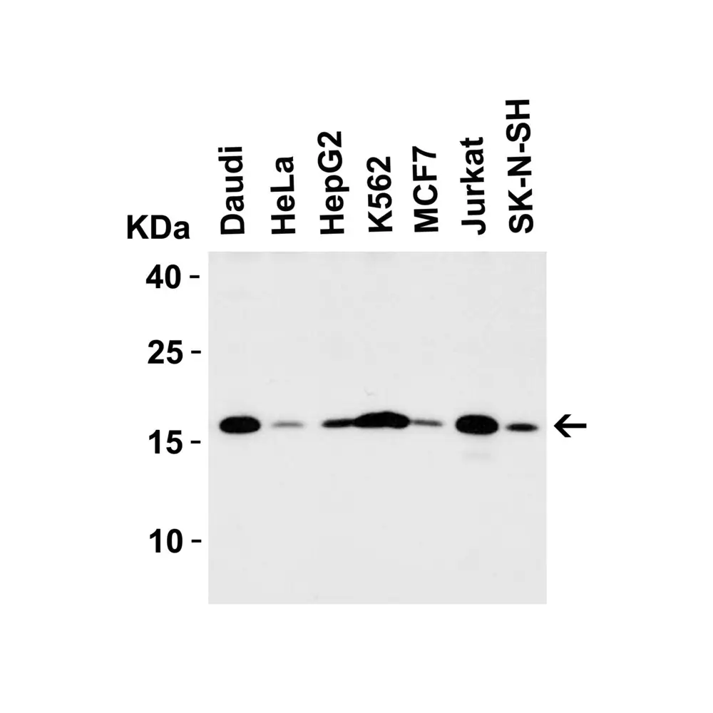 ProSci 4235 op18 Antibody, ProSci, 0.1 mg/Unit Tertiary Image