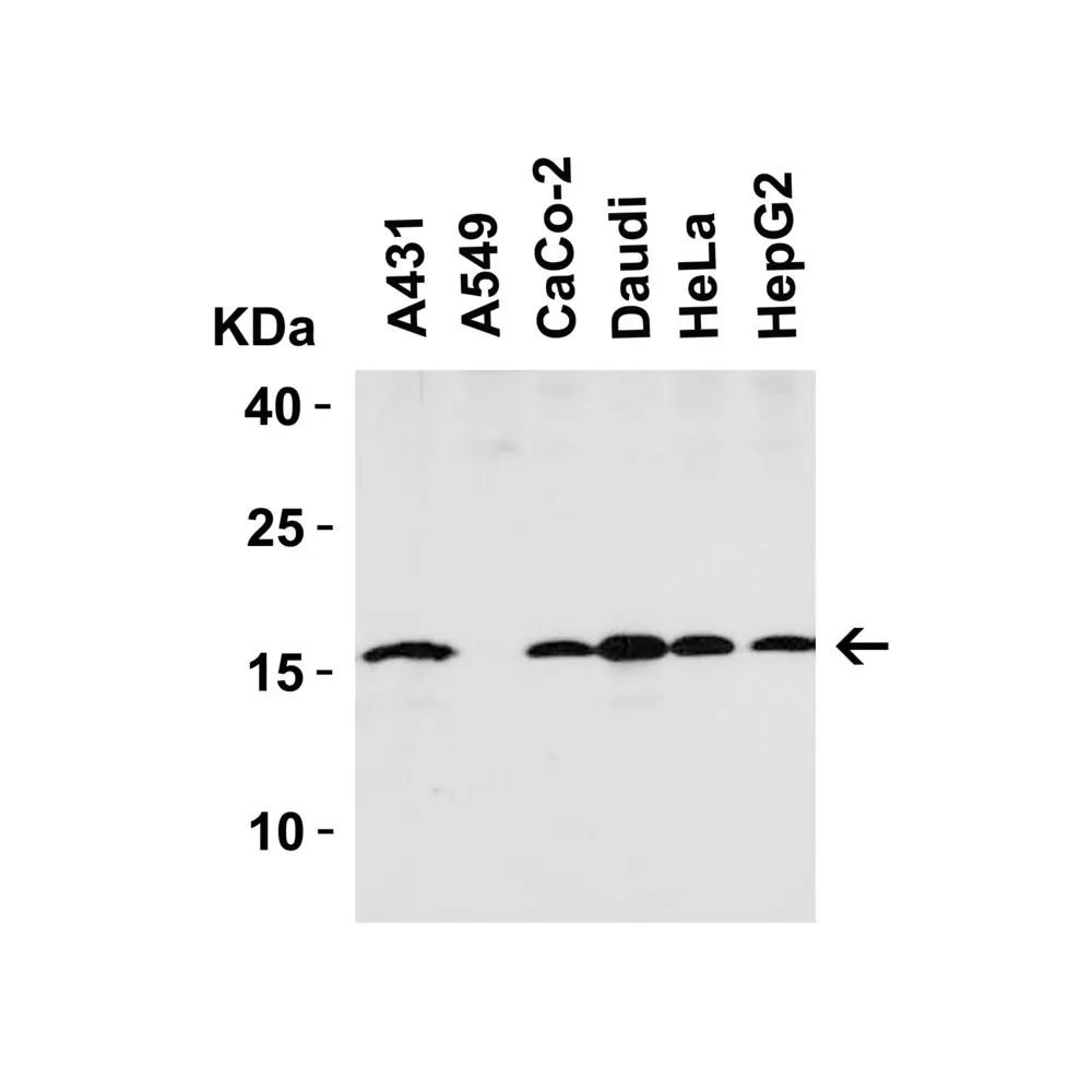 ProSci 4237 op18 Antibody, ProSci, 0.1 mg/Unit Tertiary Image