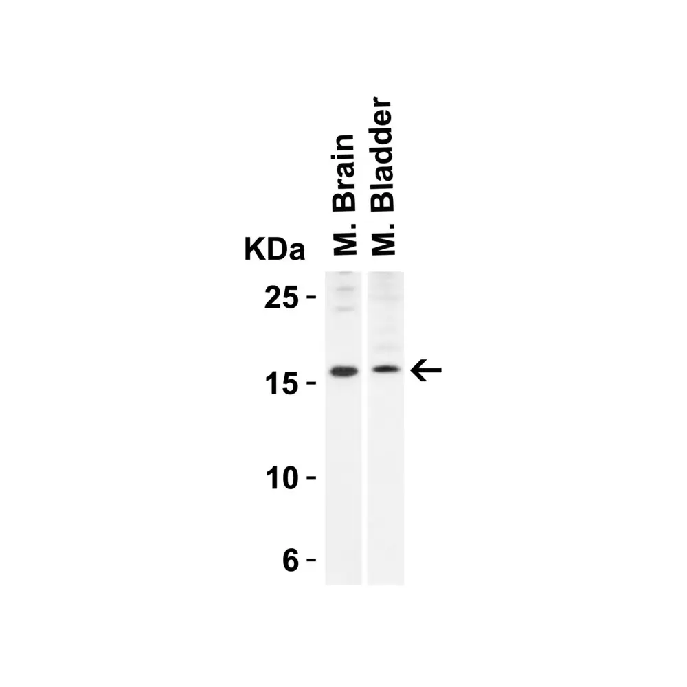 ProSci 4237 op18 Antibody, ProSci, 0.1 mg/Unit Quaternary Image
