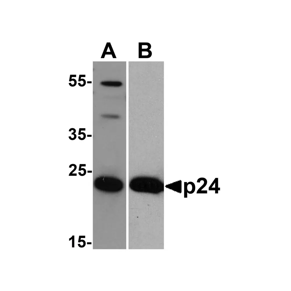 ProSci PM-6335_S HIV-1 p24 Antibody [8G9] , ProSci, 0.02 mg/Unit Primary Image