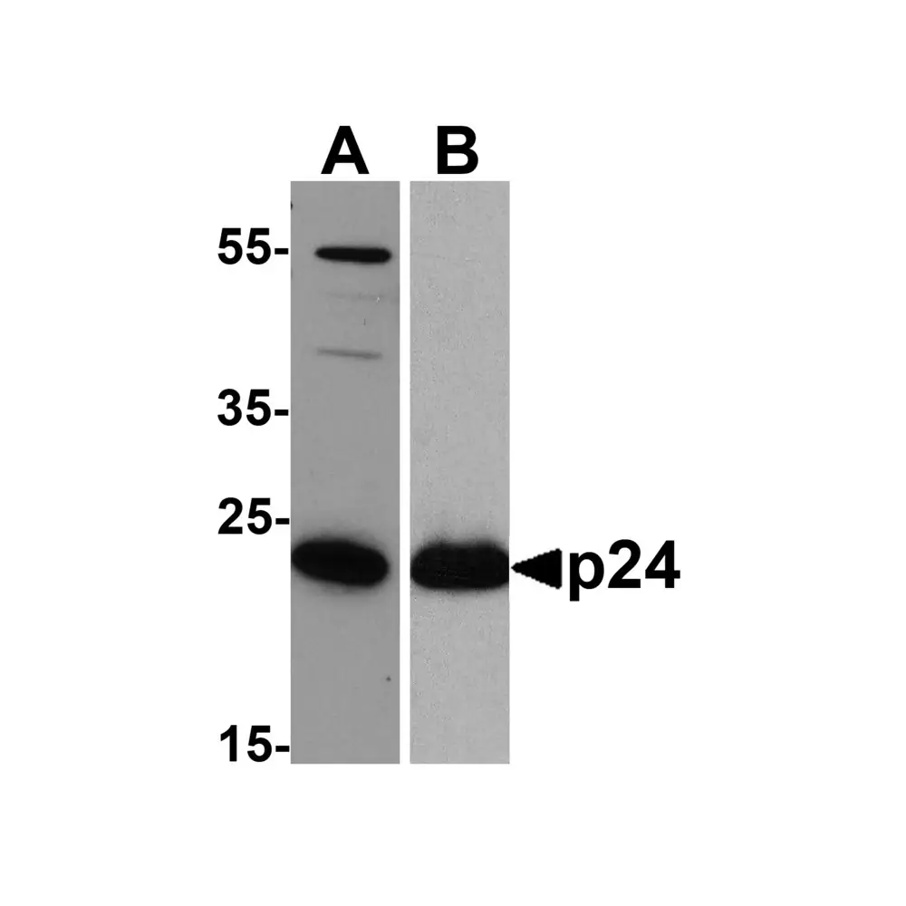 ProSci PM-6585_S HIV-1 p24 Antibody [7F4] , ProSci, 0.02 mg/Unit Primary Image